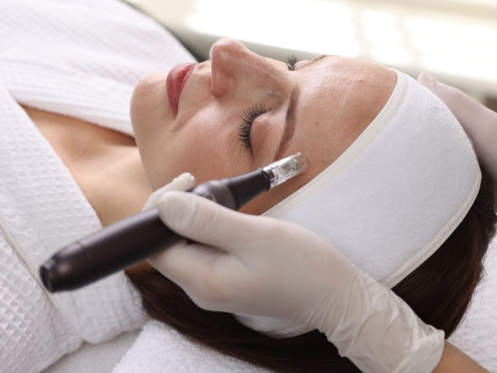microneedling