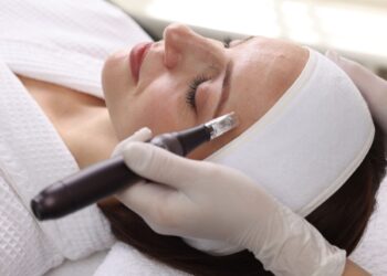 microneedling